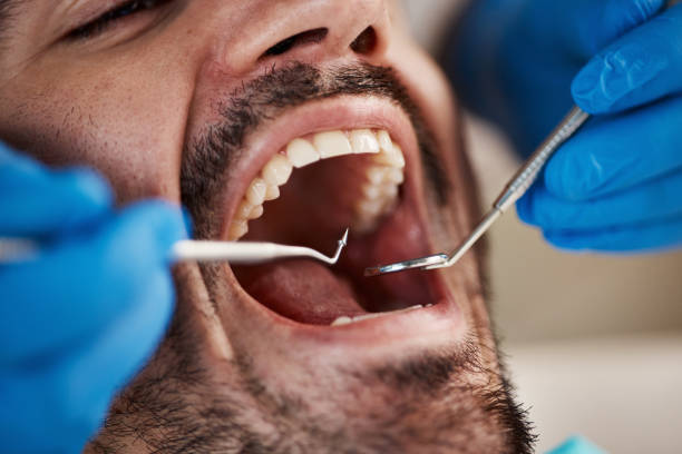 Best Emergency Treatment for Oral Infections in Oak Grove, LA